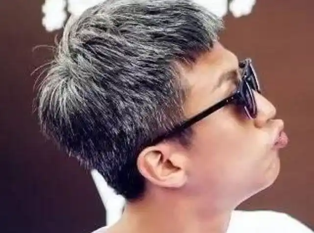 白发长在哪,病就从哪出?长在前额,两鬓,后脑勺,都意味什么?|黑发|皱纹