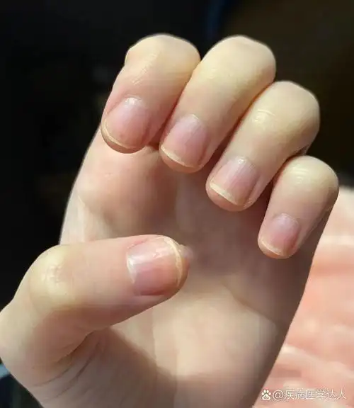 这种短宽指甲怎么养?