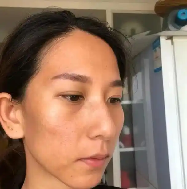 为什么女人的肌肤暗沉蜡黄?除了熬夜,还有以下几点是关键所在!