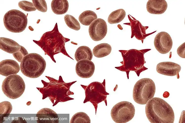 棘细胞,有刺状突起的异常红细胞