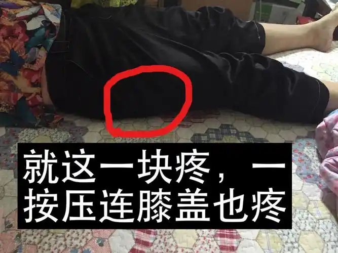 女,50岁,昨天早晨走路锻炼回家后,右腿大腿外侧疼痛,腿部觉得沉重