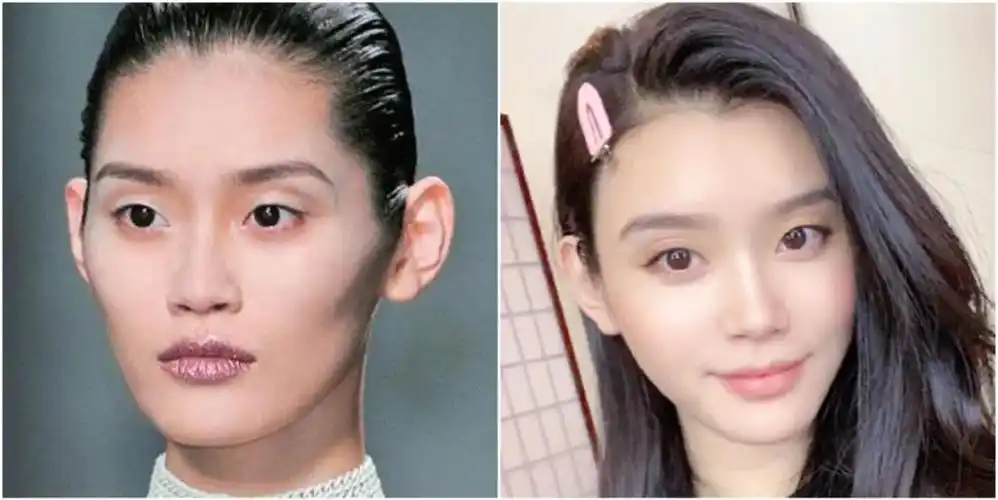 奚梦瑶这镰刀般的双眼皮是医疗事故吗为了千亿儿媳宝座自毁高级脸