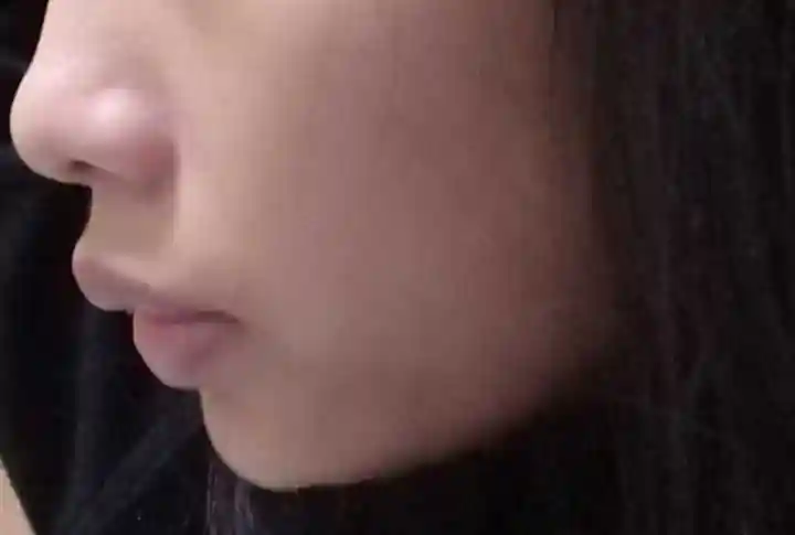 嘴凸到底能有多丑?