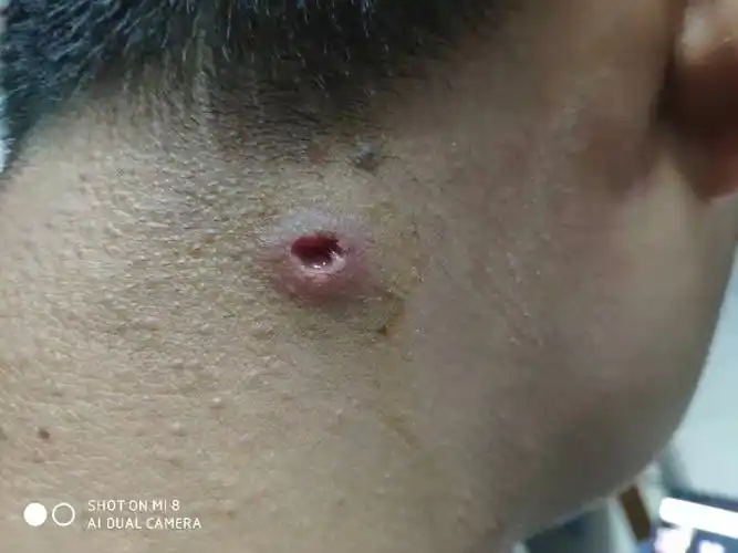 这几天一直有用碘酒消毒和百多邦.