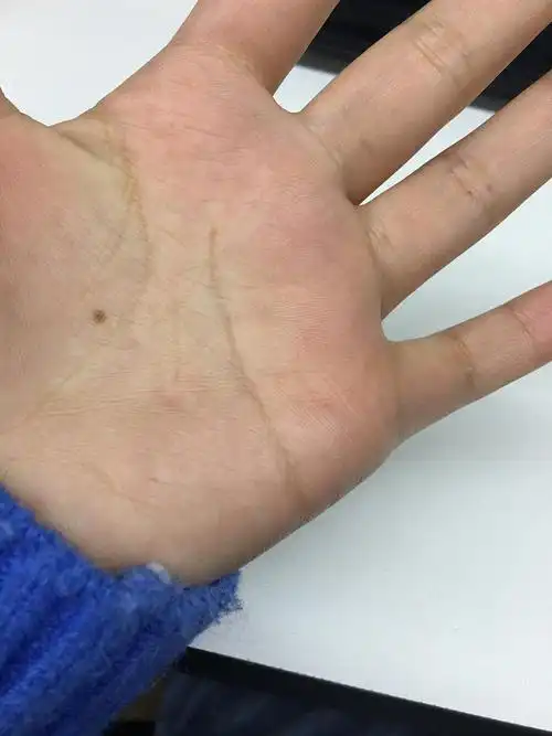 寻左手有痣的男人