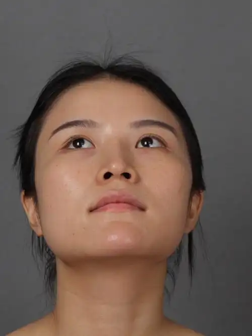 我是典型的高颧骨脸,侧面尤其明显,喜欢那种甜美无辜_圈子-新氧美容