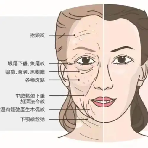 年轻的脸,基本上会是[一r]皮肤紧实,平滑[二r]肌肉张力不过强,没有