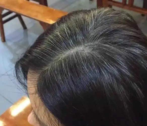 有白头发最好不要染日常多吃这3种食物或可以让白头发少一些