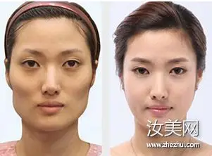 别再拿"颧骨高,不旺夫"来呛我了!