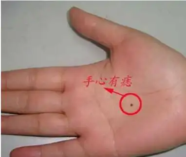 手背有痣是厄运?贫道为你识破谣言,女性这部位有痣,你就发了!