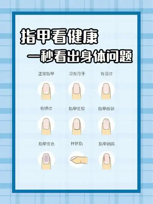 9898指甲也能反应出人体健康,通过指甲颜色,大小,形状就能判断出