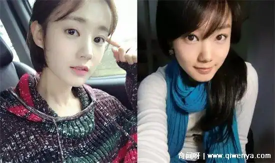 李一桐整容呀对比前后