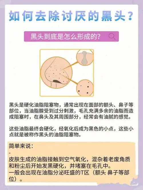 干货60如何去掉讨厌的黑头71