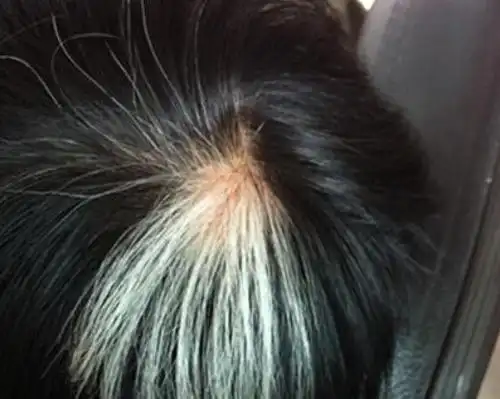 十几块钱的食疗方就能根治!每天一次,很快就白发变黑!