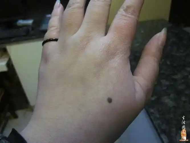 手背痣运势 手背厄运痣图解