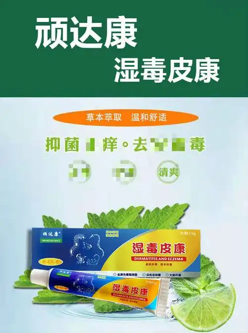 湿1疹皮1炎专用湿毒皮康止痒膏皮肤过敏身上痒止痒