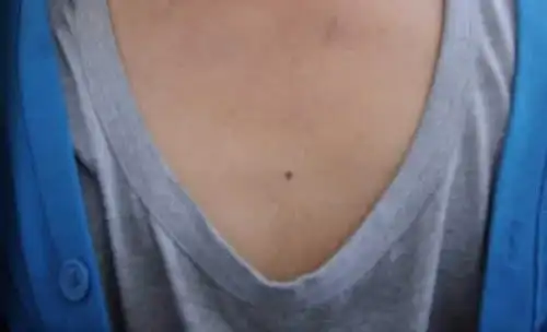 男人胸前有痣寓意及含义解读