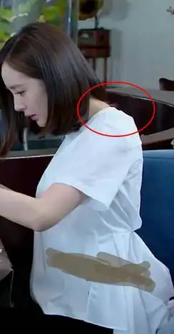 驼背,内扣~脖颈前倾3,锁骨整形——重点来了!