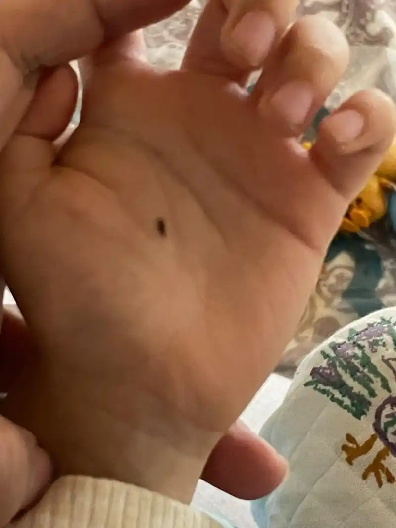 查过掌心痣相关的说法,多想马上就告诉你,担心将来你的情路坎坷,自不