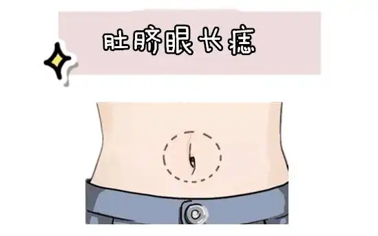 肚子有痣的位置与命运肚子上痣的位置与命运图解