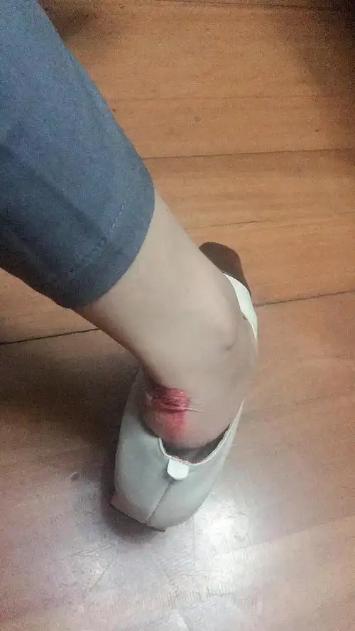 回到家才发现后脚跟流了这么多血