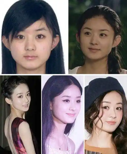 女星整容前后对比,有人美貌出众,有人惨不忍睹_柳岩