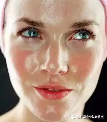 拯救你的大油脸,控油只会帮倒忙