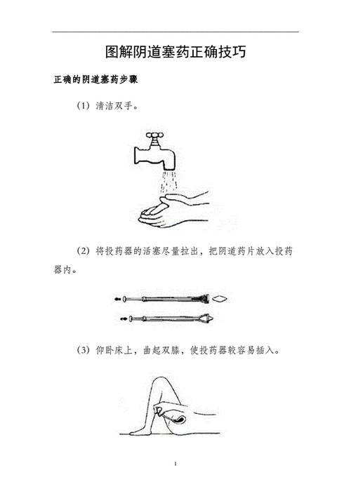 图解阴道塞药正确技巧.doc