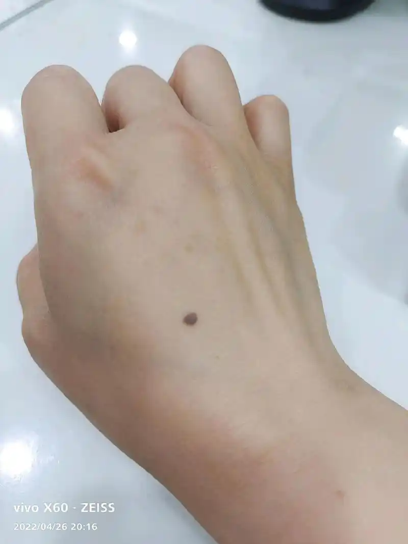 今天才发现我和姐姐在同一只手同一个地方有一颗痣9696#父母 - 抖