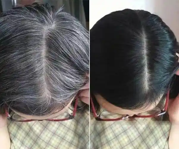 白发越长越多用这个老国货养出乌黑秀发显小10岁