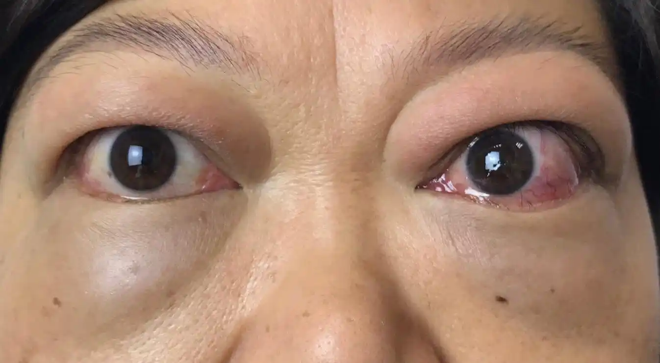 04 软组织炎症.jpg