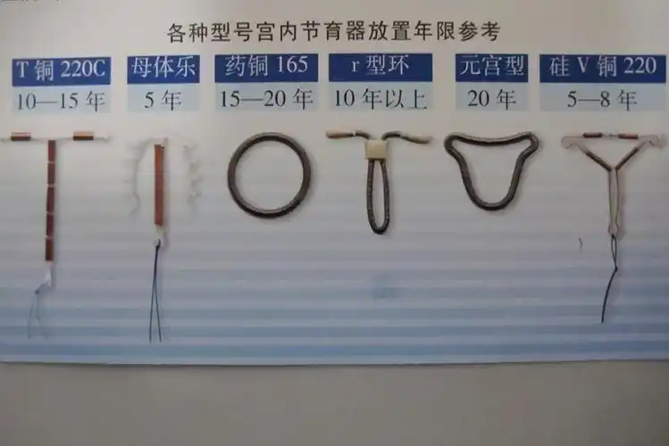 避孕环种类
