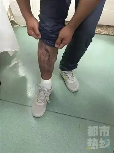 原本面临腿部截肢,是什么让陕西小伙重新站起来?神了!