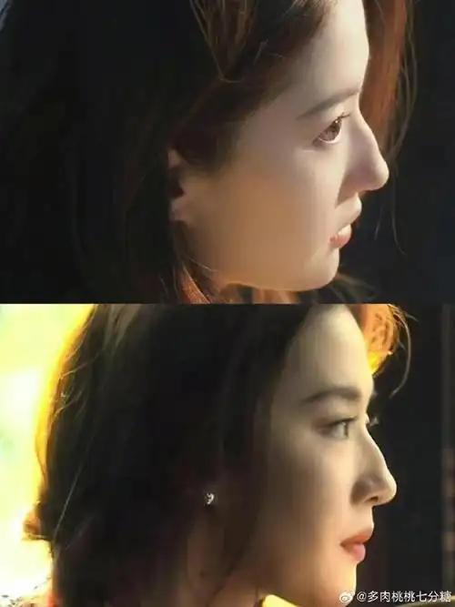 刘亦菲就是唯一的黄亦玫##刘亦菲侧颜驼峰鼻