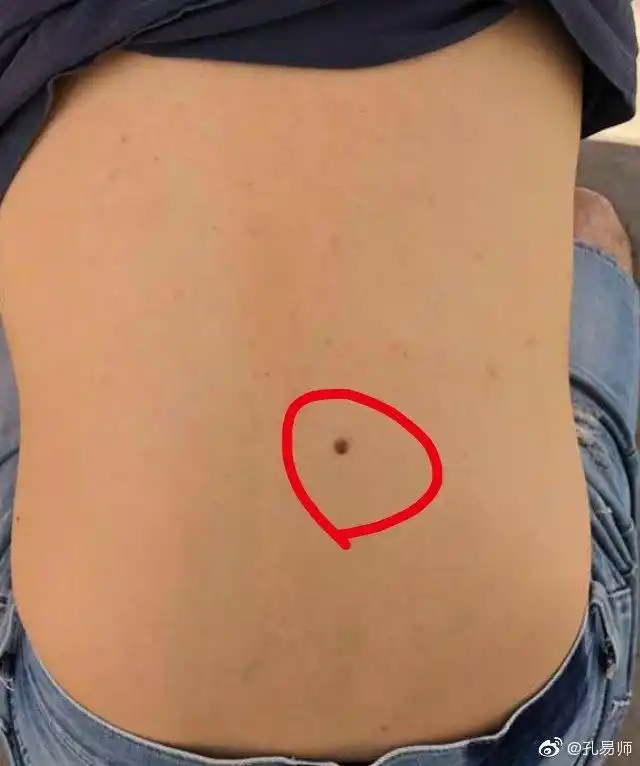 腰部痣腰部有痣～～寓意腰缠万贯,利财运.并且腰部痣还利福禄.