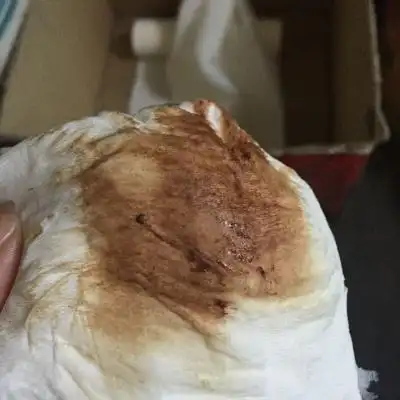 有没有宝妈和我的情况一样的,怀孕两个月出现了黑褐色的分泌物,伴有