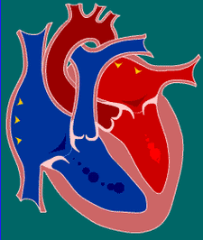 你好,小孩一出生买的险,结果四岁的时候查出来先天性心脏病