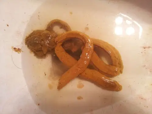 最近发现大便有凹痕,像被什么切过一样