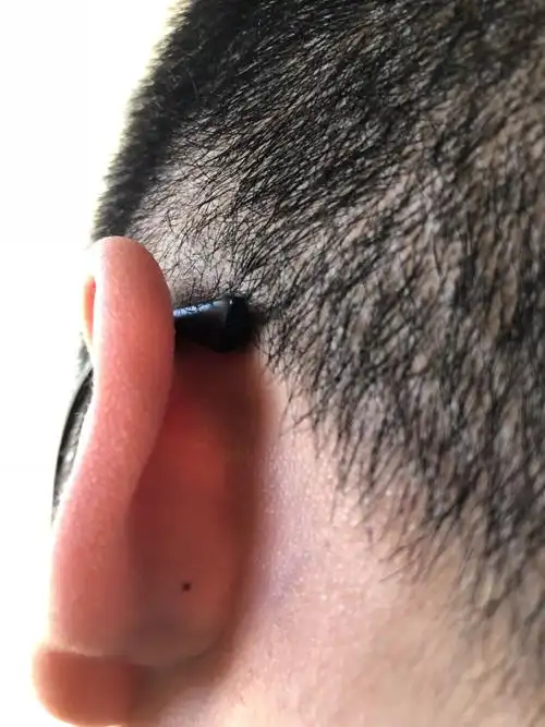 耳朵后面长了个这个 好不好