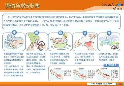 【安全一刻】烫伤急救5步骤