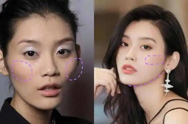 奚梦瑶整容了鼻头缩小面部填充明显秀鸽子蛋大钻戒超奢侈