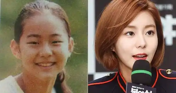 韩国整形成功的女明星(10位大方承认整形的韩国明星)(5)