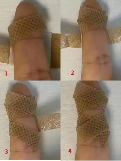 非关节处贴创可贴,左上方胶黏条向右下方贴,右上方胶黏条向左下方贴