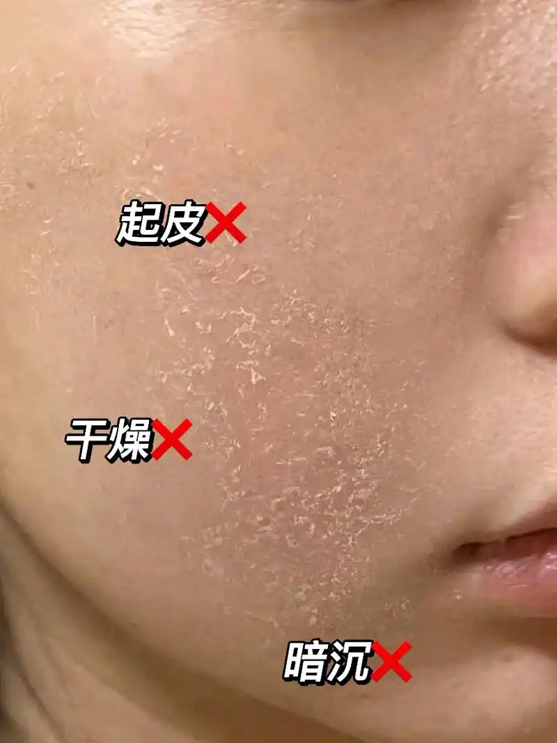 脸上干巴巴,皮肤干燥粗糙缺水,显得老!那就试试#白云山烟酰 - 抖音