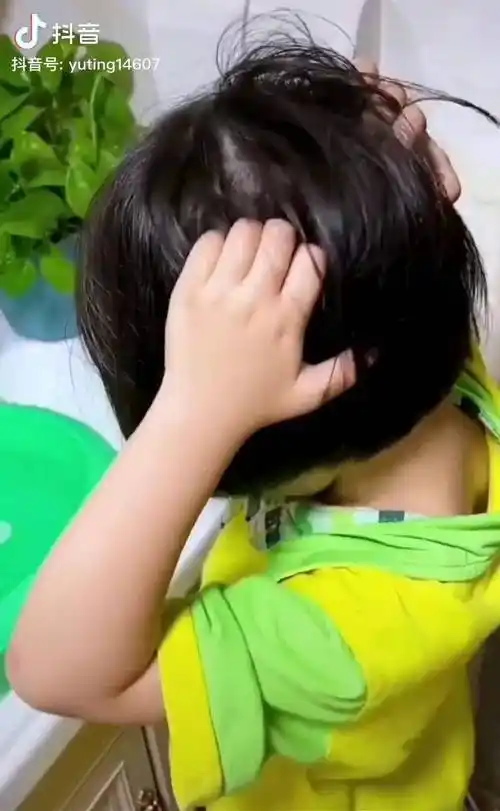 长头发女宝宝总是不停抓头发,要仔细给孩子看看是不是长头虱 了,如果