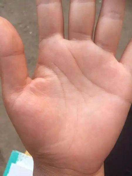 看手相月丘那是星号吗?