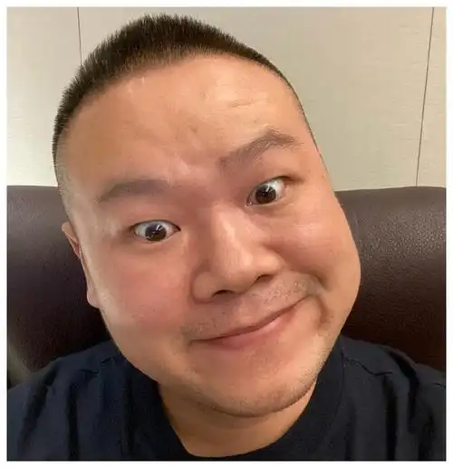 所以现在非常能理解为什么岳云鹏一直坚持寸头了,就像很多脱发严重的