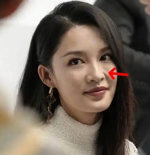 看到李沁的这组生图后,评论区很多人都在说她的皮肤状态,满脸的痘痘