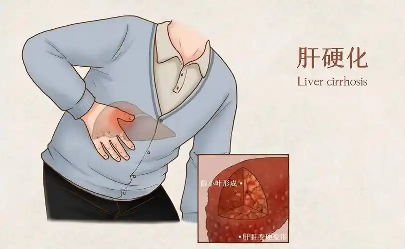 肝脏_肝功能_疾病