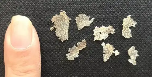 慎入我大概抠出了世界上最大的头皮屑